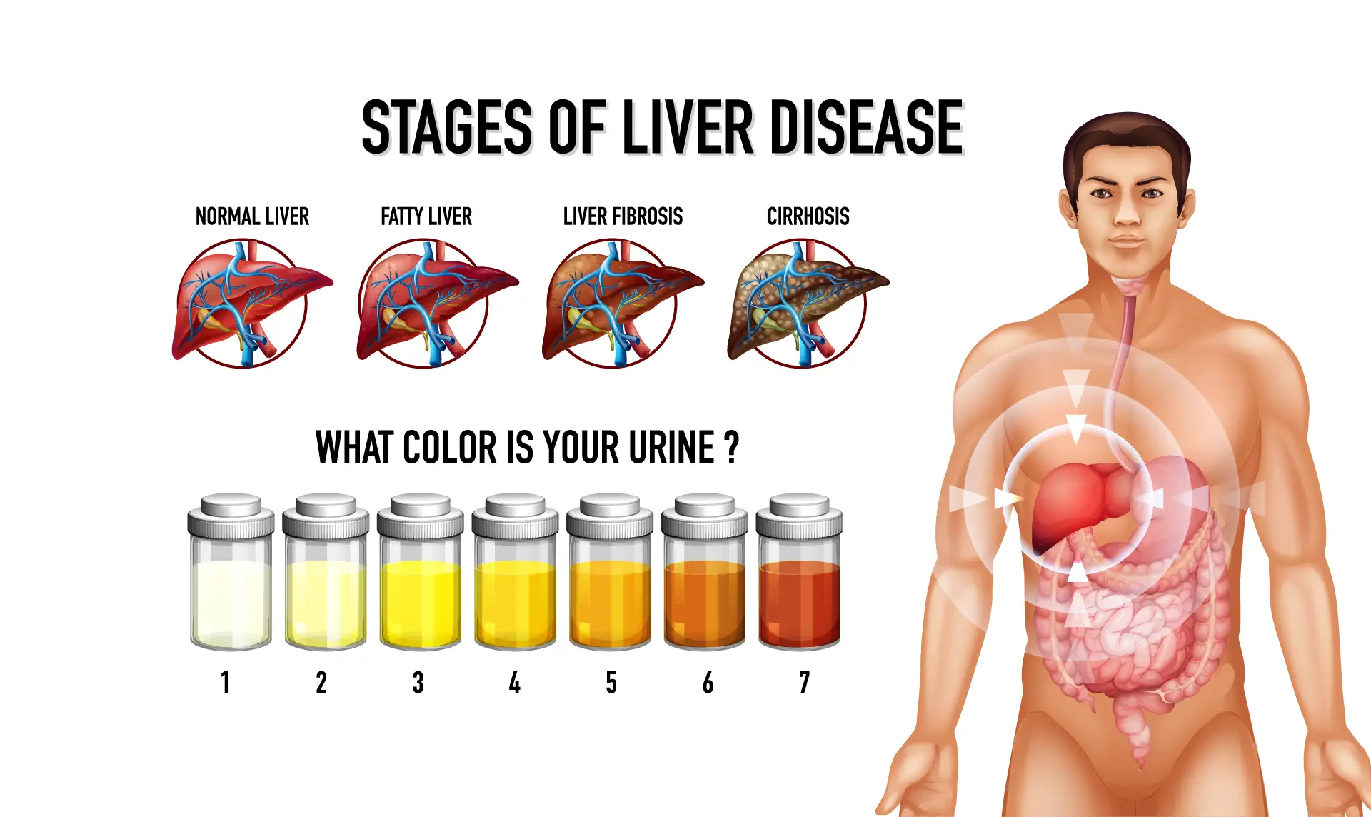 Liver disease