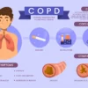 COPD treatment