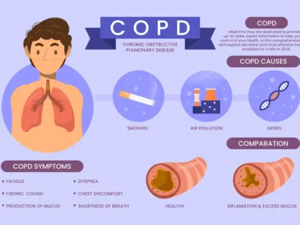COPD treatment