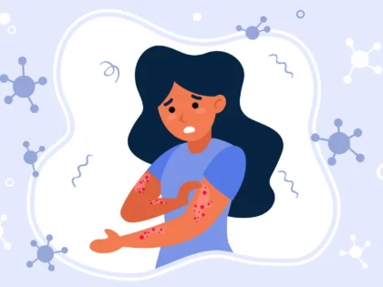 How to Prevent Chickenpox In 2025